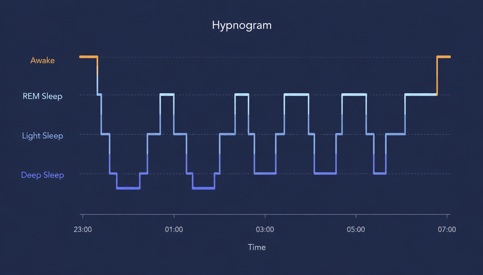 A hypnogram showing the night's progression through Awake, REM, Light and Deep sleep stages from 23:00 to 07:00